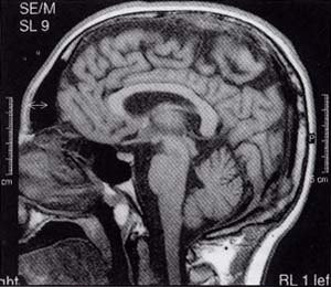 lupi_fig1.jpg (26519 byte)
